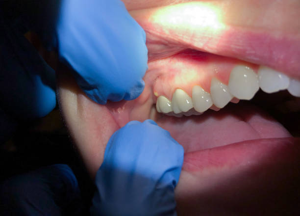 Best Emergency Dental Services for Seniors in Juneau, AK
